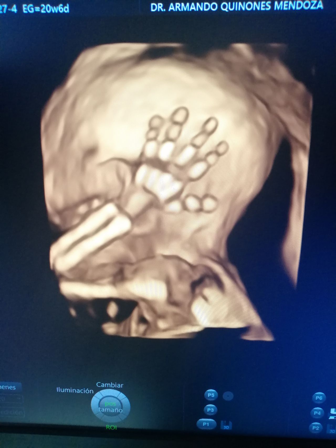 Armando Quiñones Mendoza-19