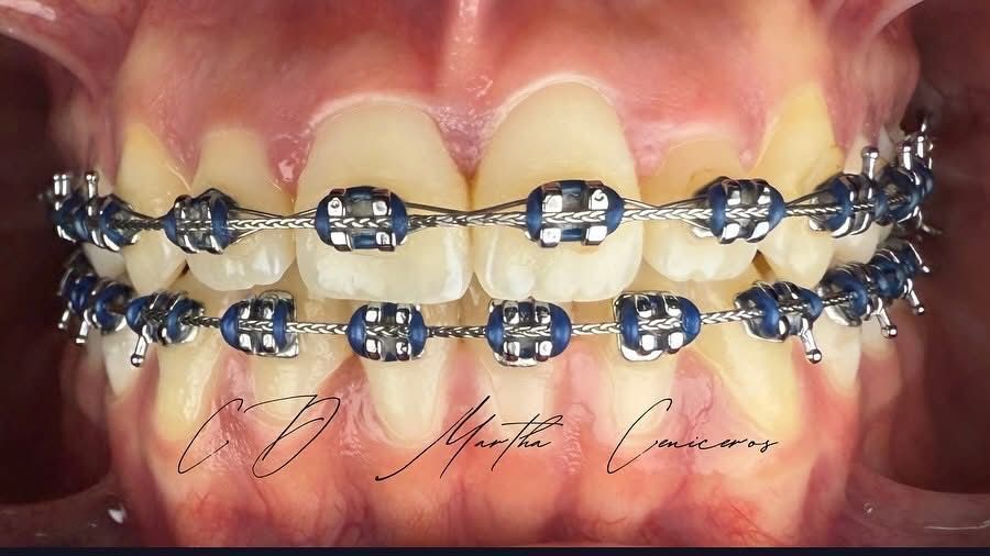 Martha Alicia Ceniceros Betancourt-24