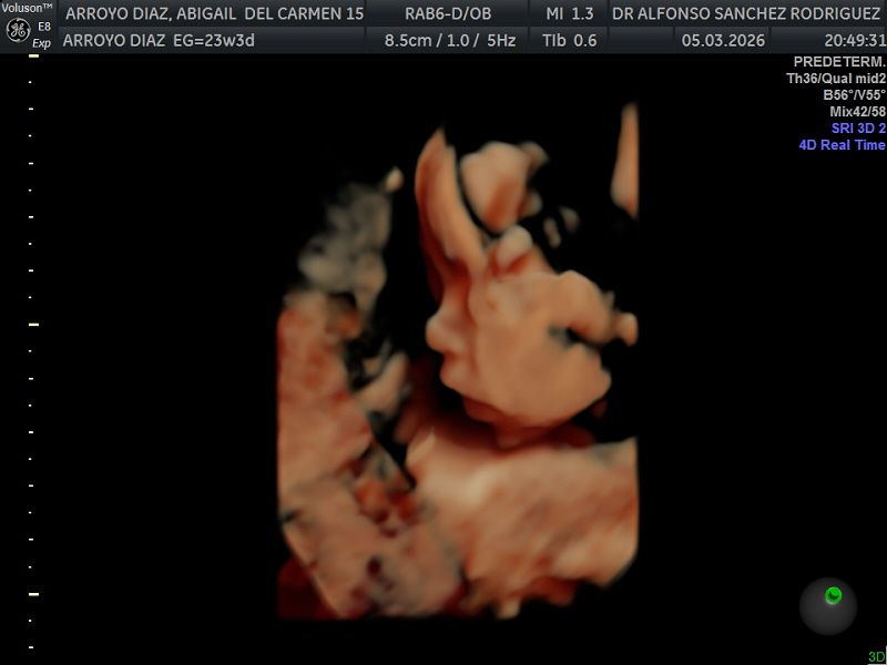 Alfonso Sanchez Rodriguez-56