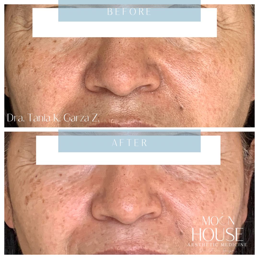 Tania Karine Garza Zepeda-11