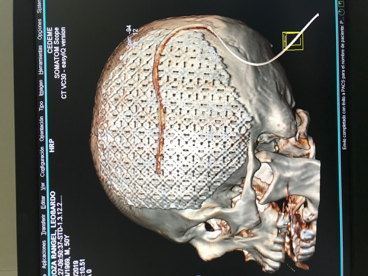 Rafael Maciel Morfin-5