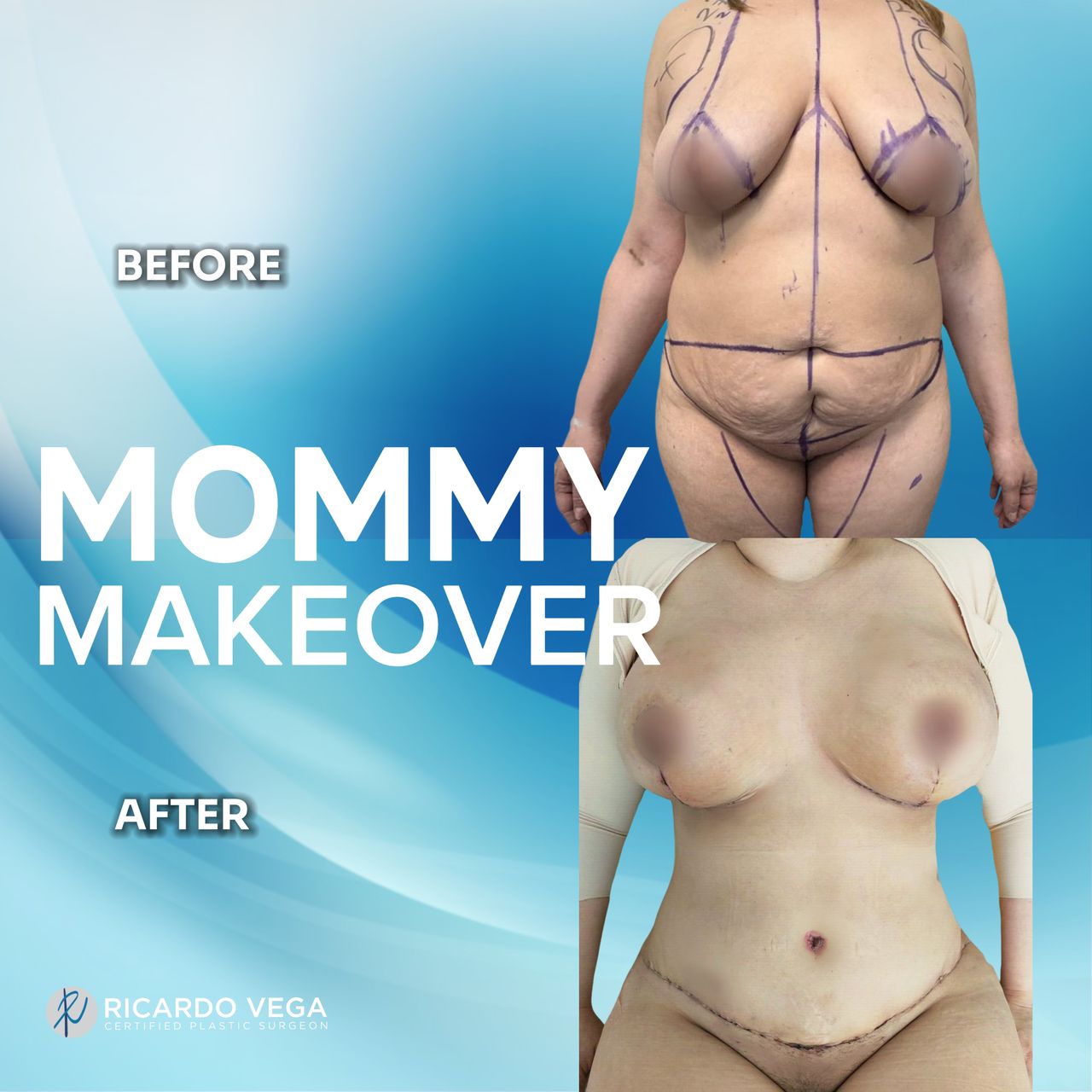 Ricardo Vega Montiel-5