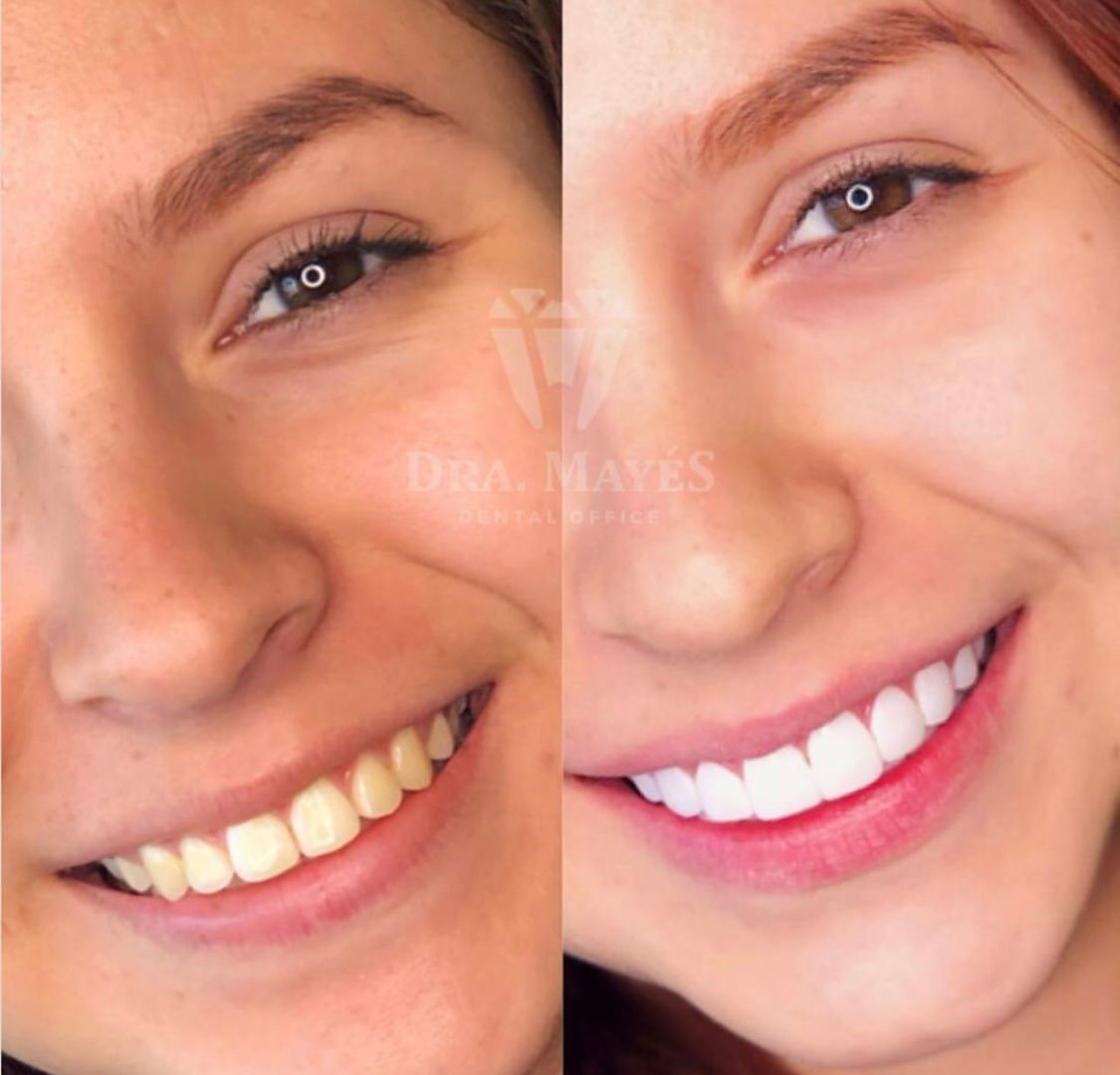 Marijose Mayes Merelles-3