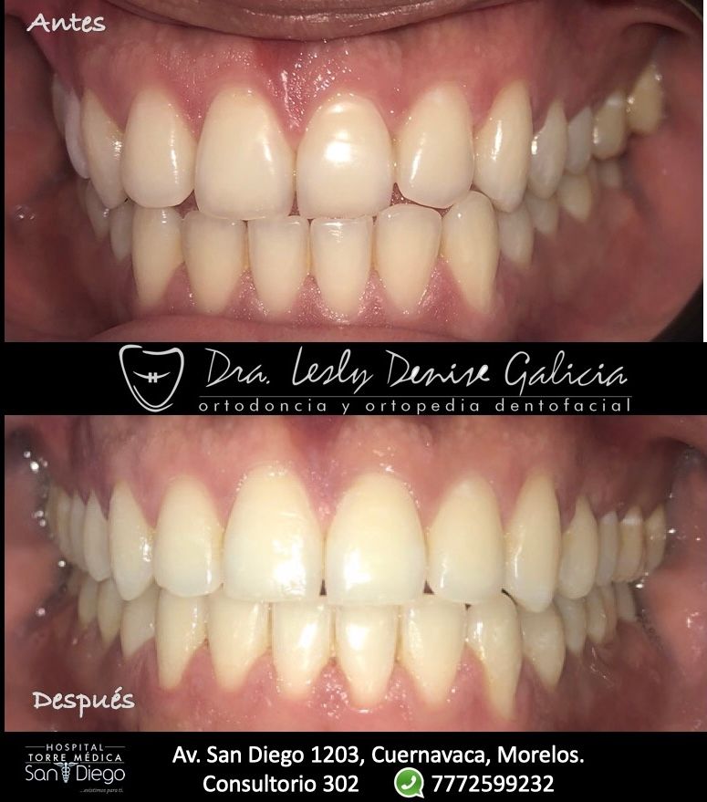 Lesly Denise Galicia Borjas-1