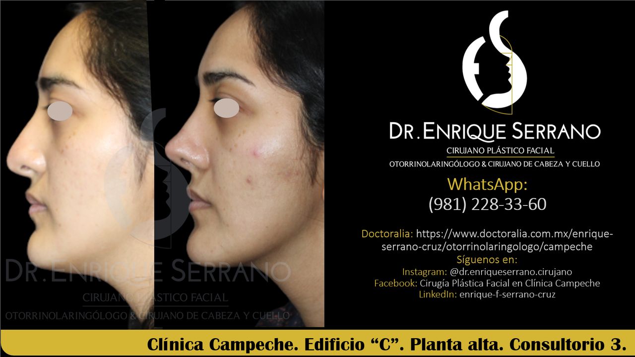 Enrique Serrano Cruz-63