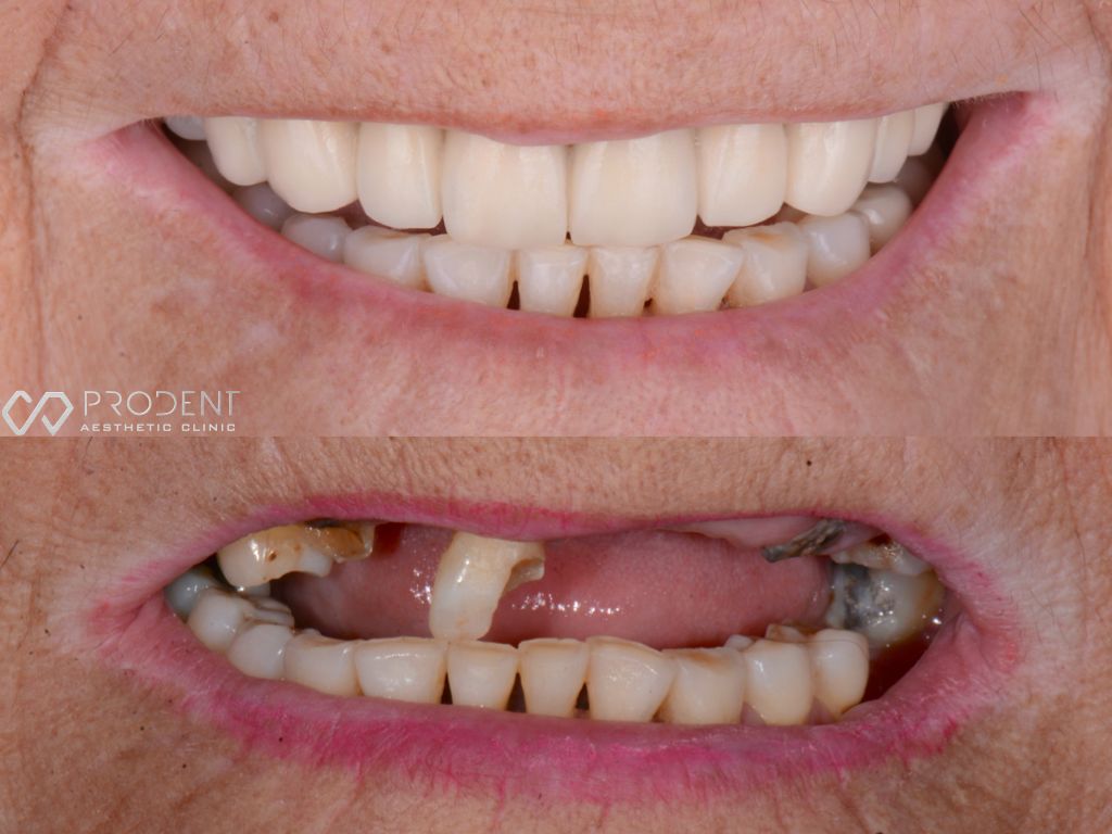 Ulises Pérez Murillo-98