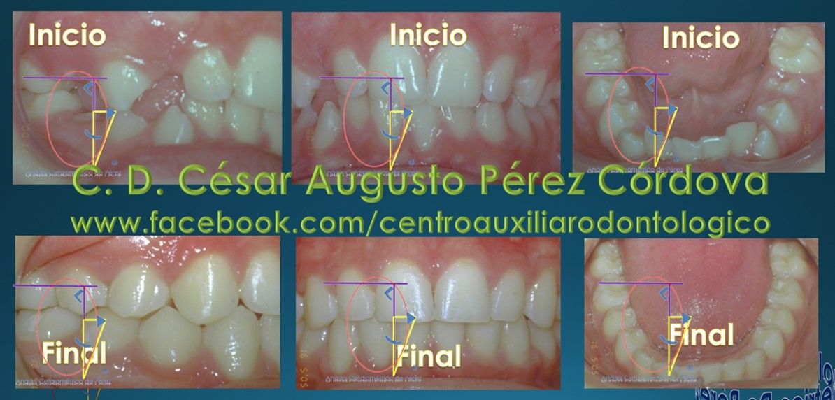 César Augusto Pérez Córdova-41