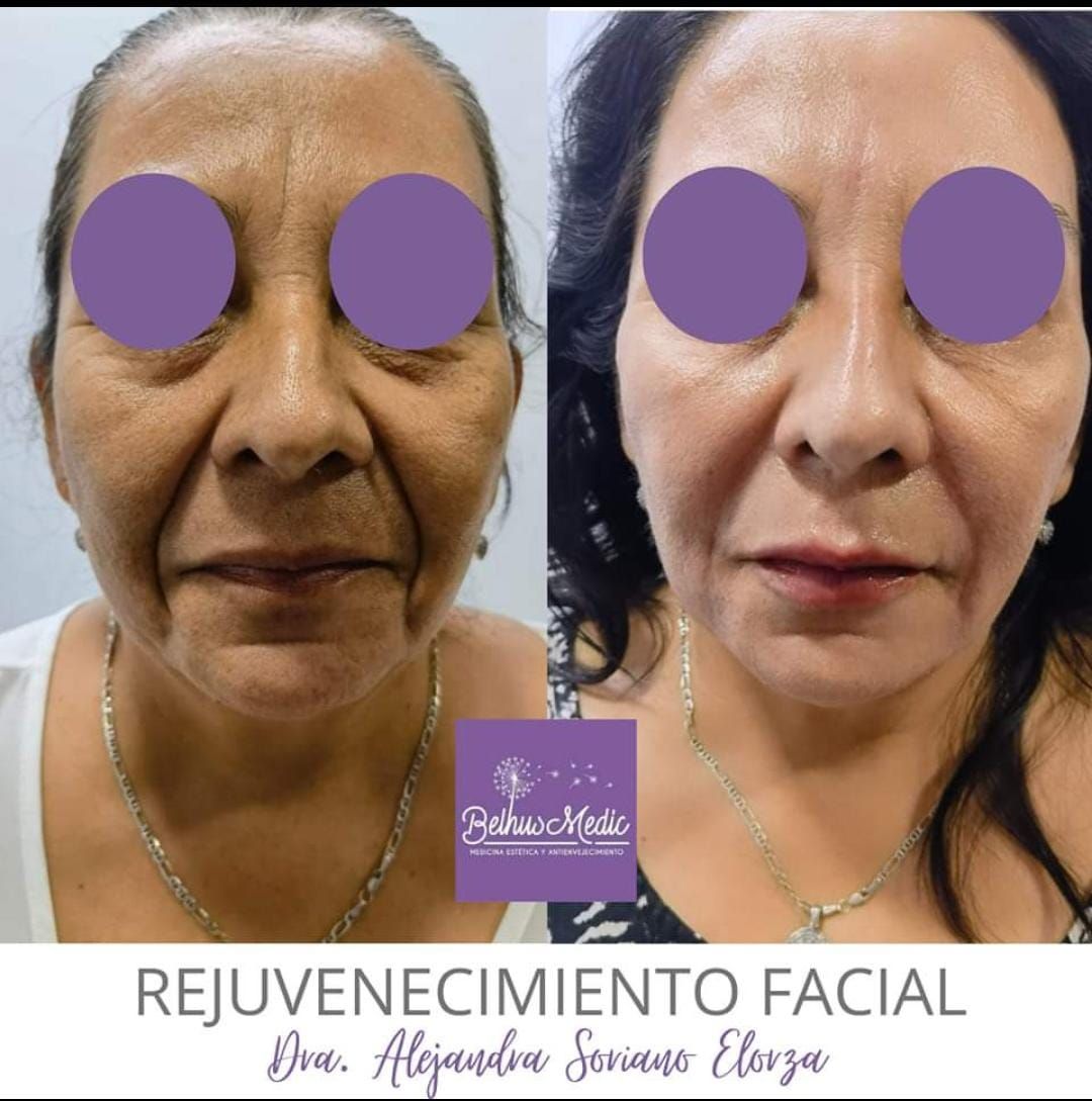 Alejandra Soriano Elorza-34