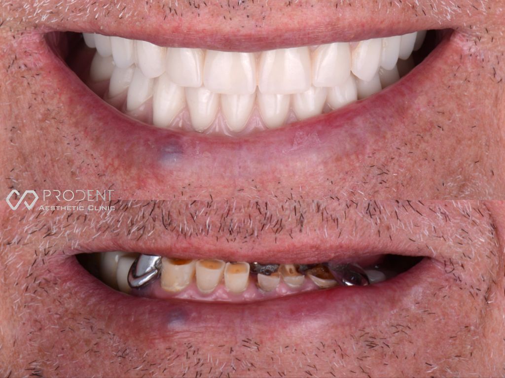 Ramiro Ivan Pérez Murillo-12