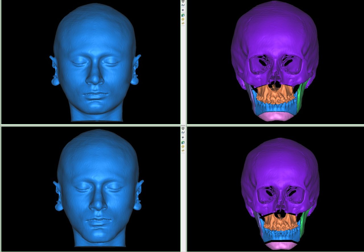 Nancy Valeria Lara Gayosso-22