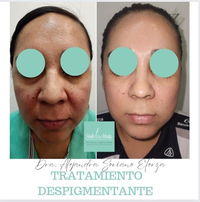 Alejandra Soriano Elorza-58