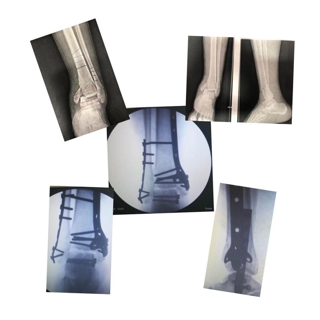 Alejandro Hernandez Frias-11