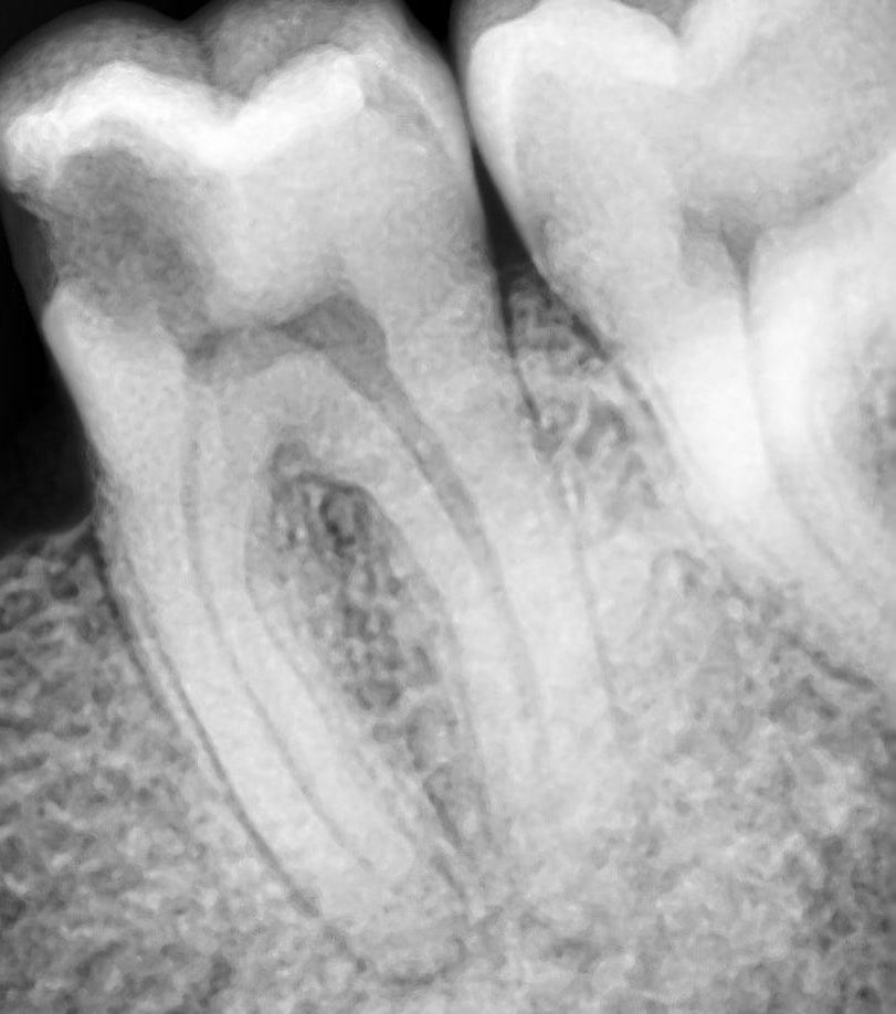 Esmeralda Candida Guerrero Pimentel-28