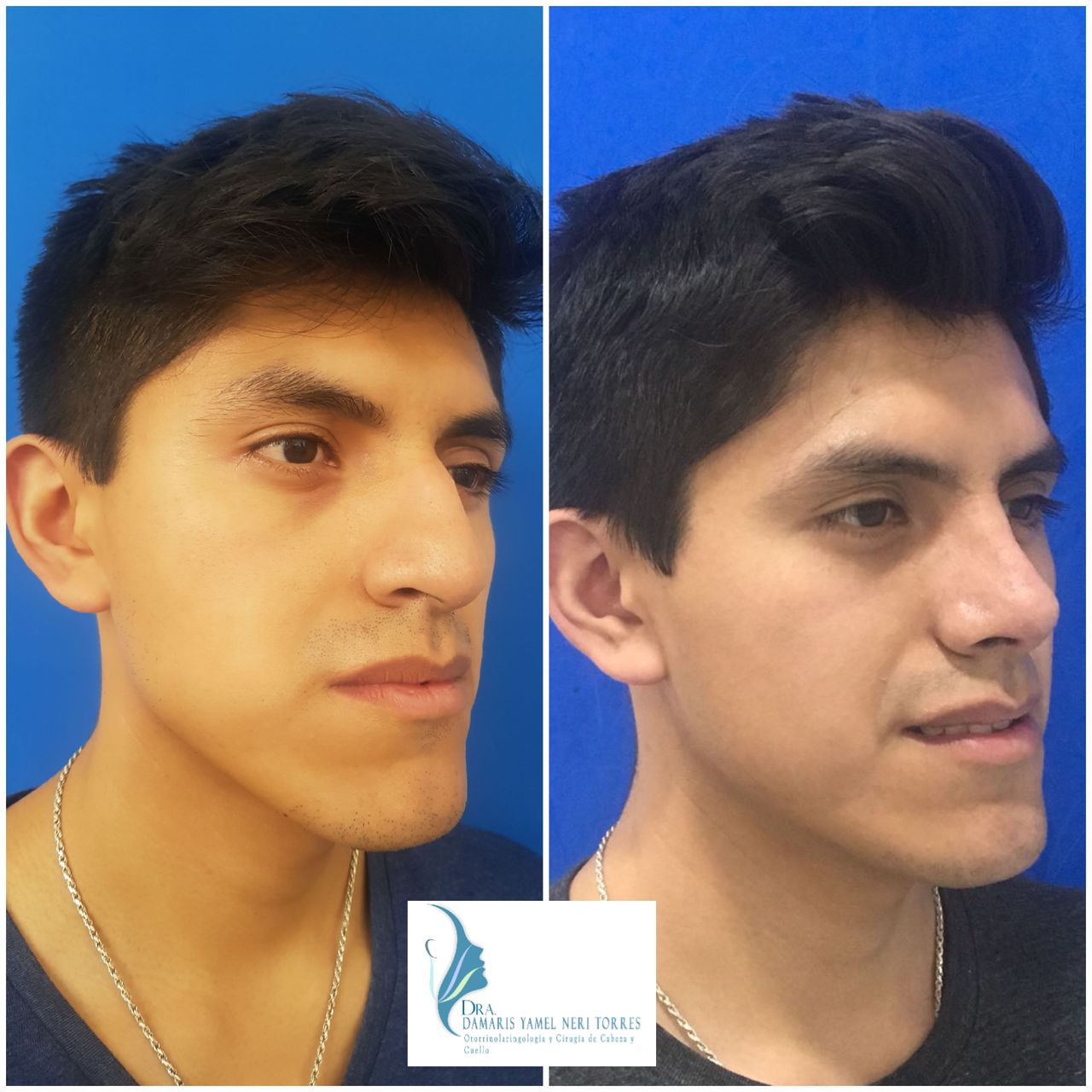 Damaris Yamel Neri Torres-7