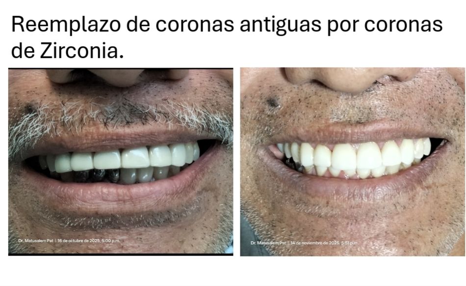 Matusalem Pat Avilés-1