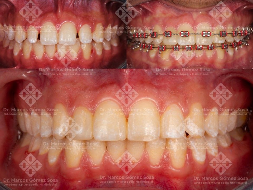 Marcos Gómez Sosa-1