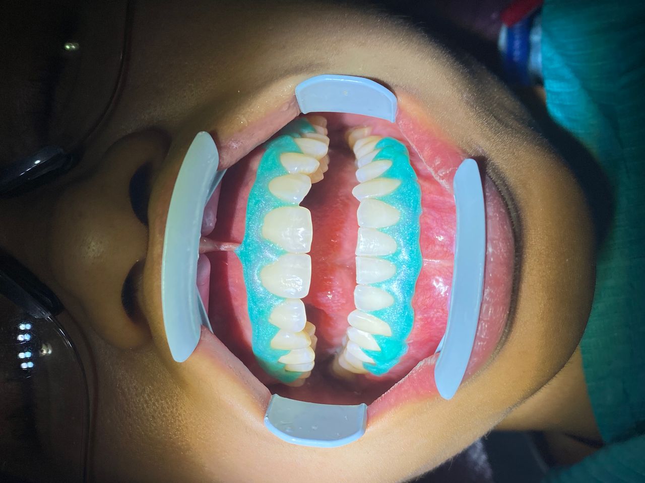 Raúl Méndez Cifuentes-27