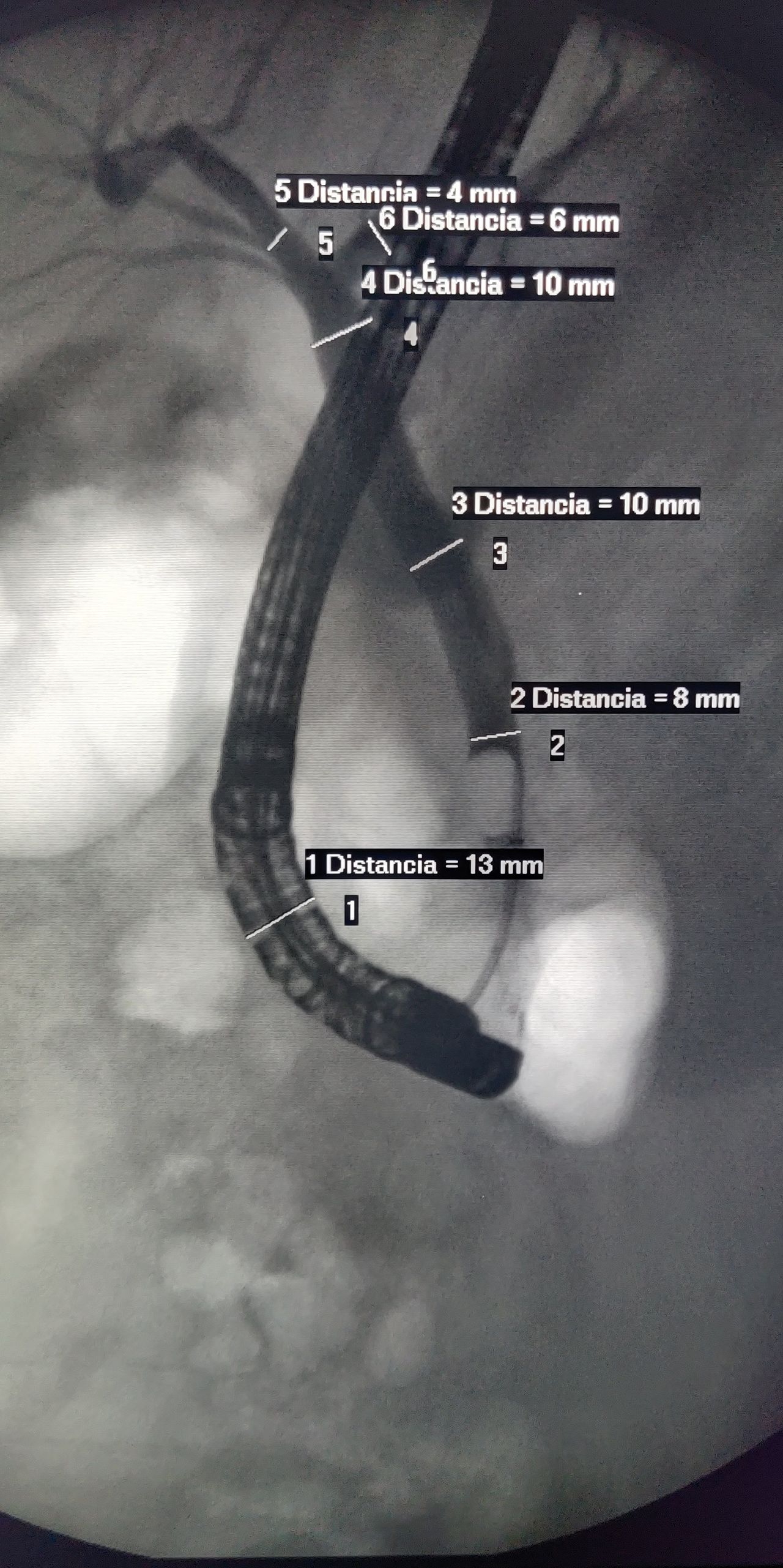 Rodrigo Robles Zavaleta-11