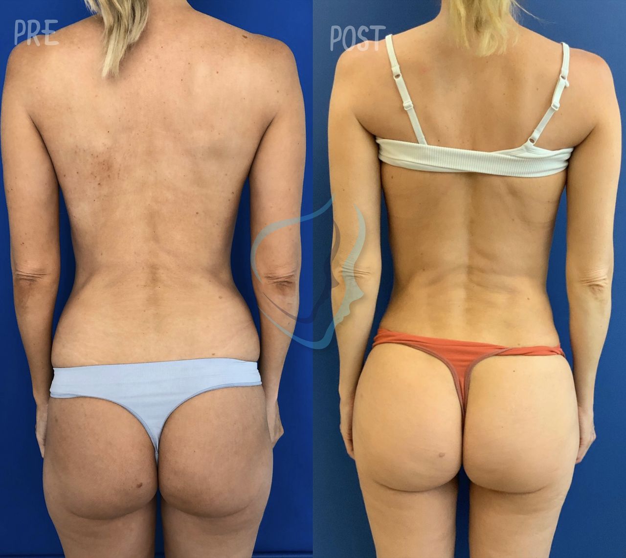 Giuseppe Tanzillo-35