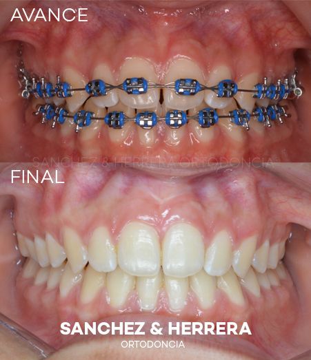 Daniel Sánchez Caamaño-6