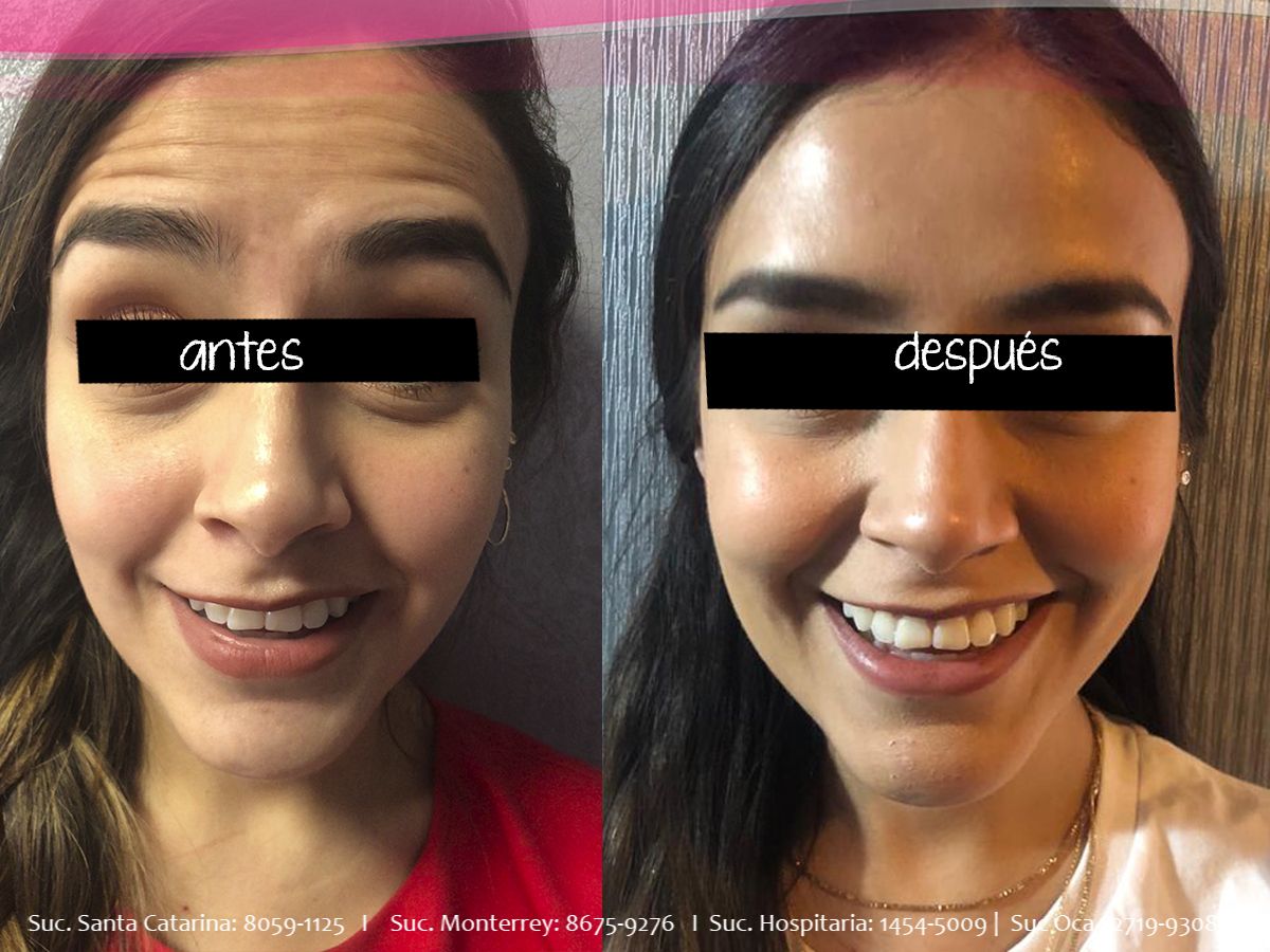 Mercedes Fernández Reyes-23