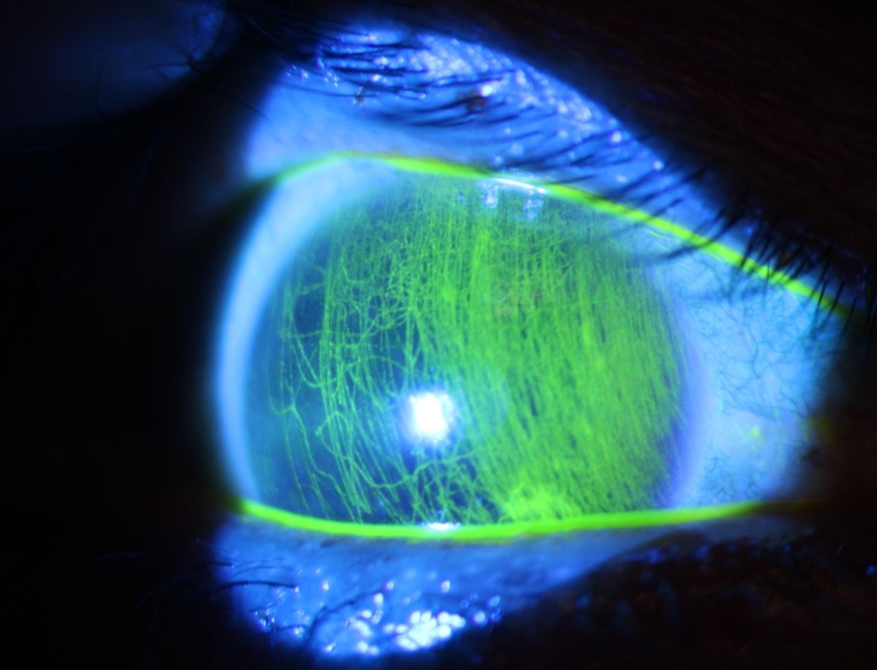 Kalid Barush Hernández Diaz-7