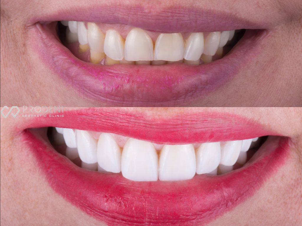 Ulises Pérez Murillo-31