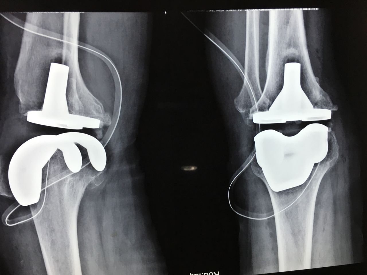 Alberto Viñas Silva-14