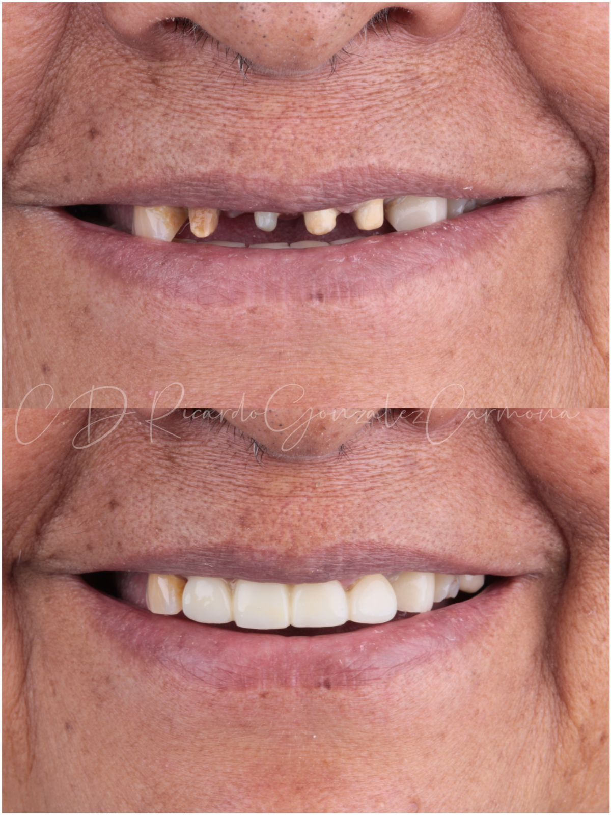 Ricardo González Carmona-5