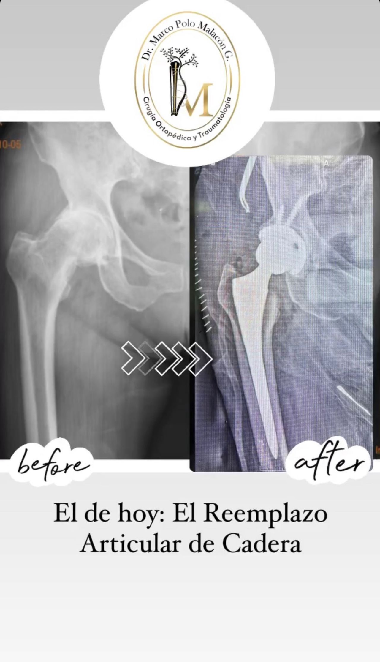 Marco Polo Malacón Gutiérrez-13