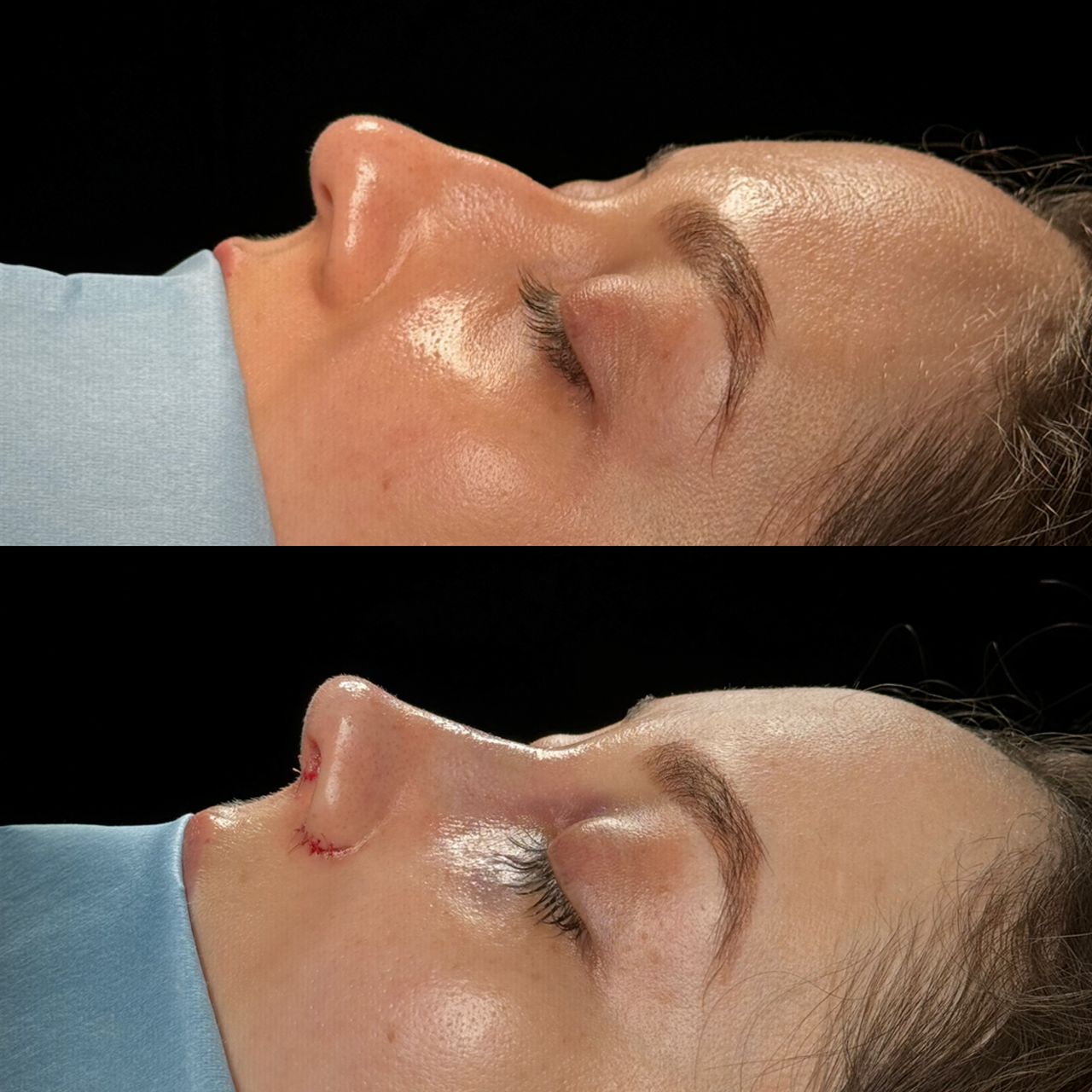 Angel Castro Urquizo-100