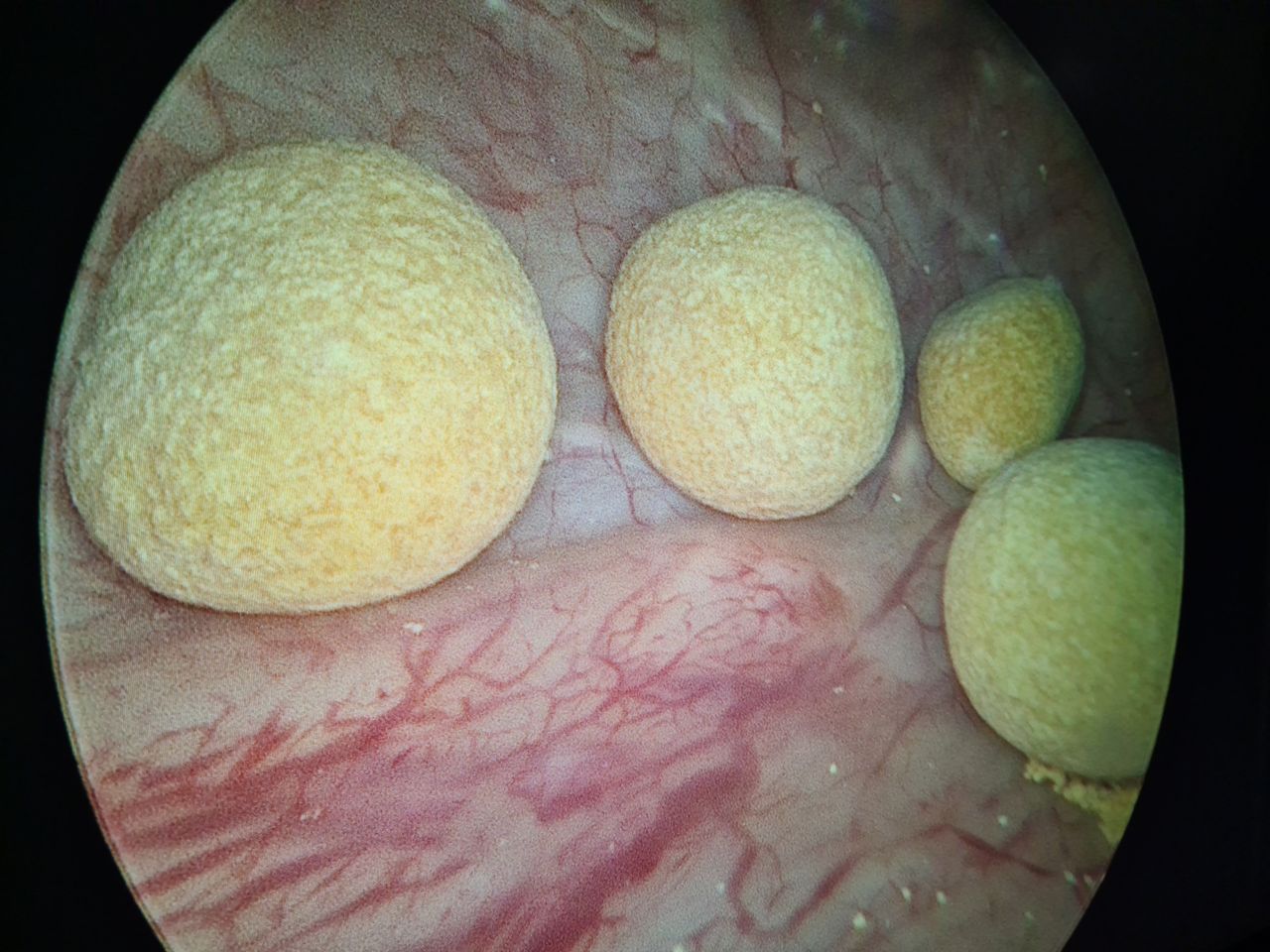 Michel Bastarrachea Solis-9