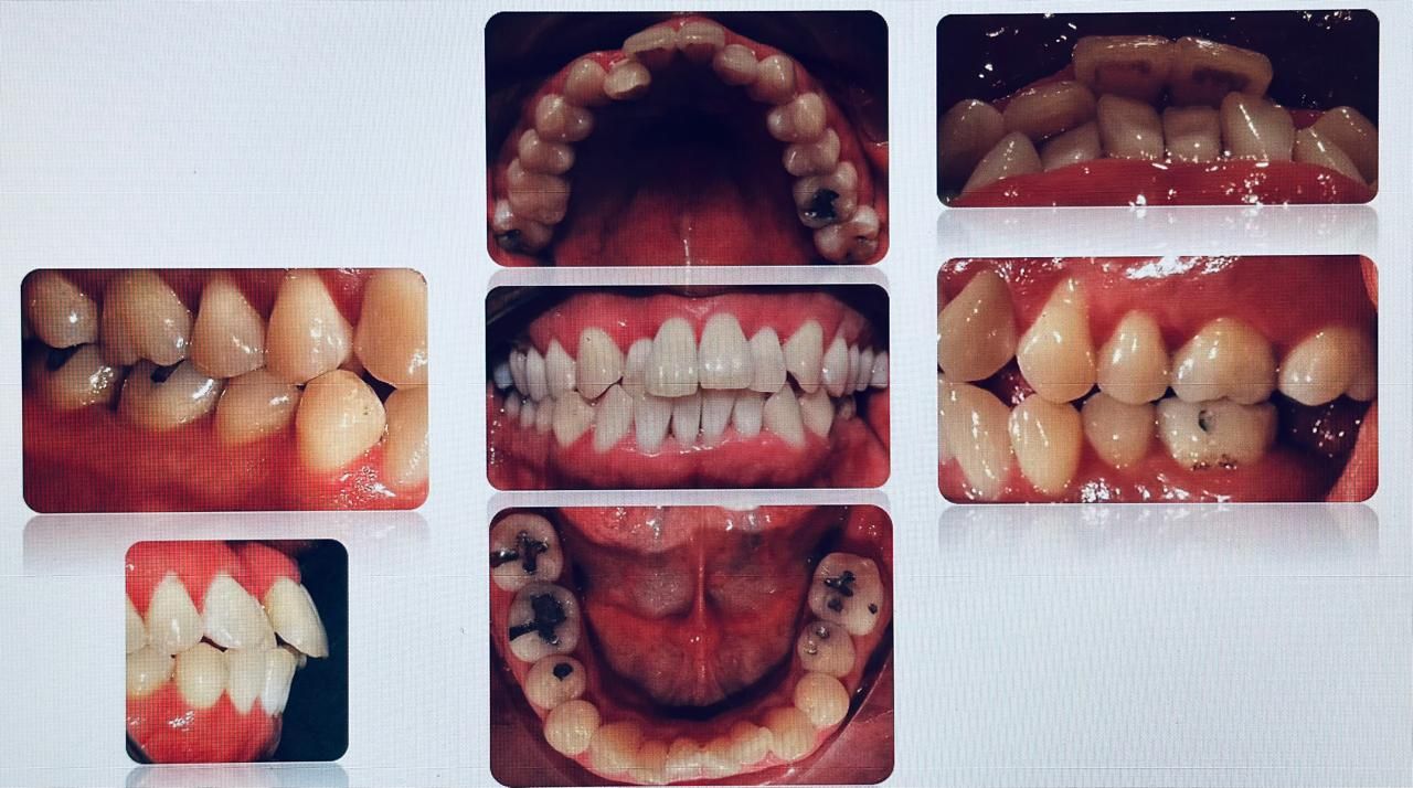 Antonio Gomez Arenas-3