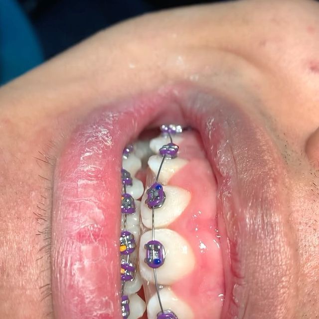 Alejandro Angelo López Díaz-16