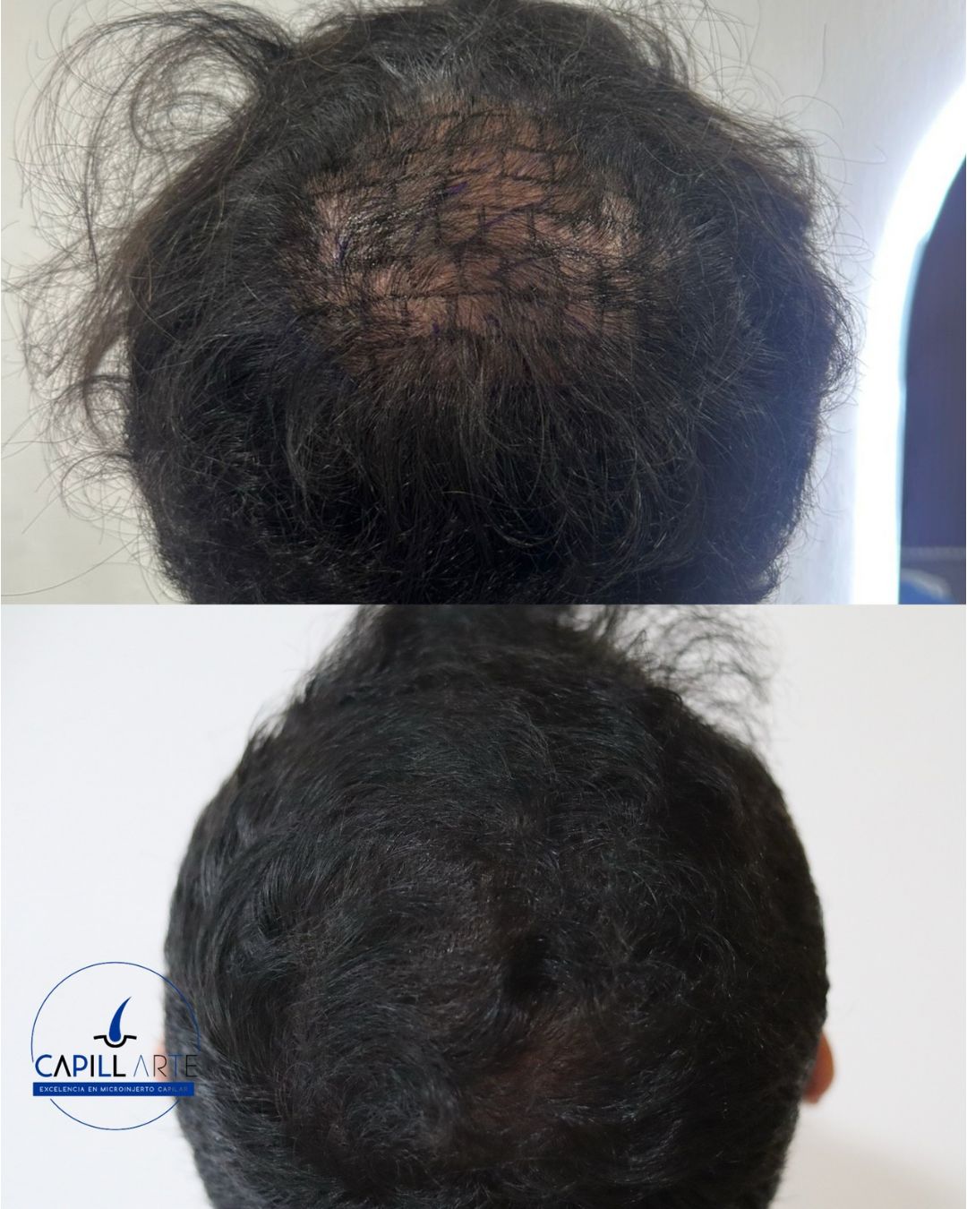 Adrian Hernandez Lopez-18