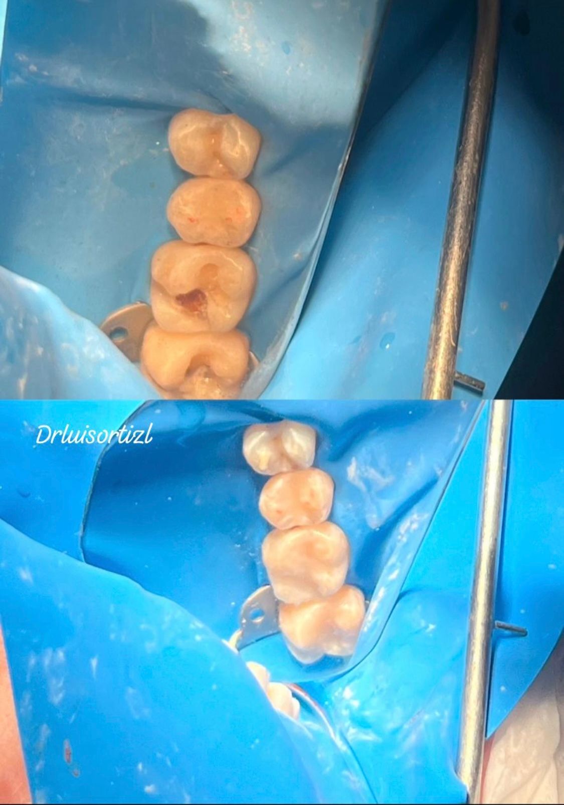 Luis Ángel Ortiz López-17