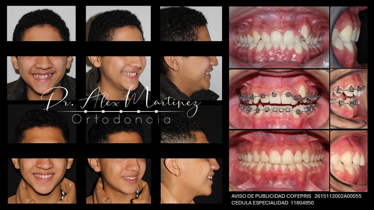 Alejandro Martínez Hernández-17