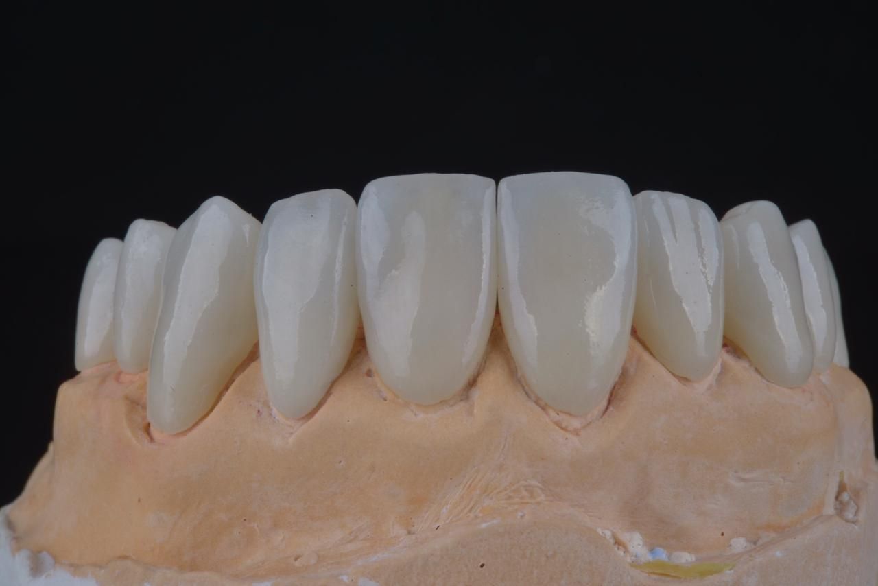 Aimee Valles Monárrez-41