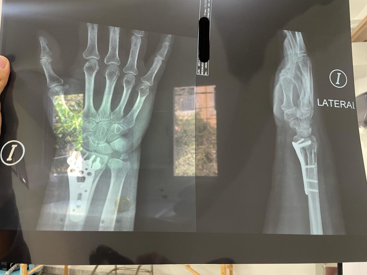 Irving Denilson Peña González-16