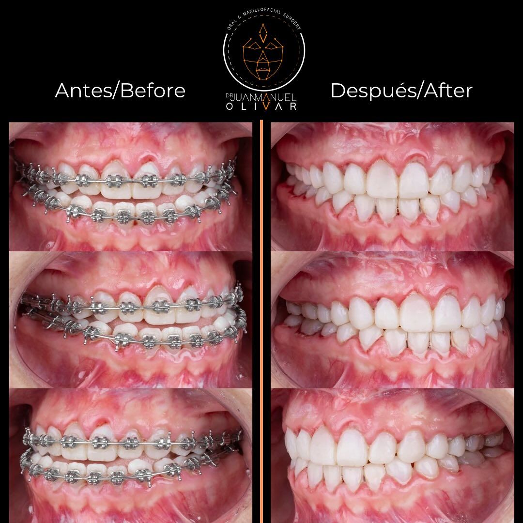 Juan Manuel Olivar Cedeño-10