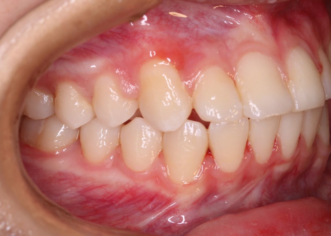 César Osvaldo Poot Chan-8