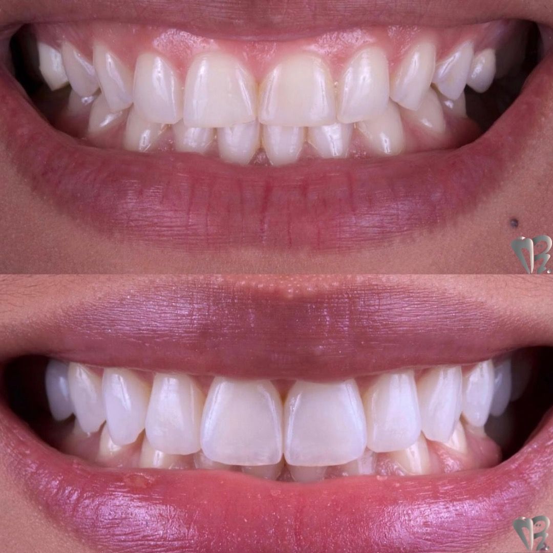 Ernesto Rojas Calderon-48