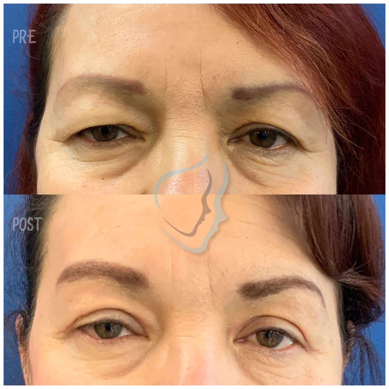 Giuseppe Tanzillo-84