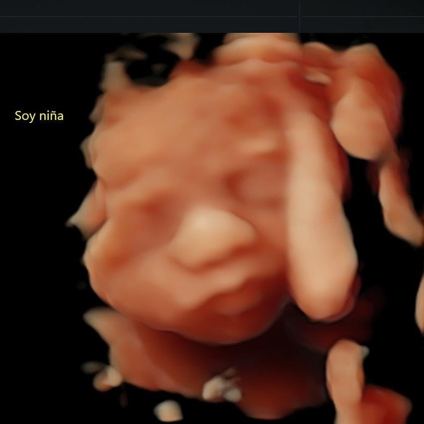 Omar Valderrama Loyola-7