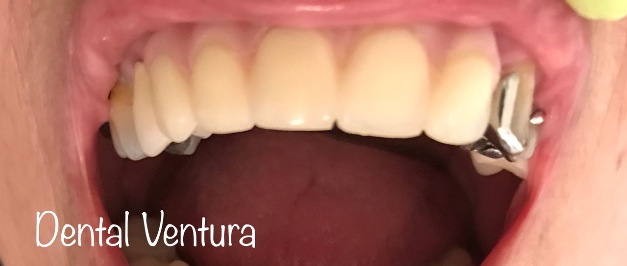 Antonio Cerda Ventura-13