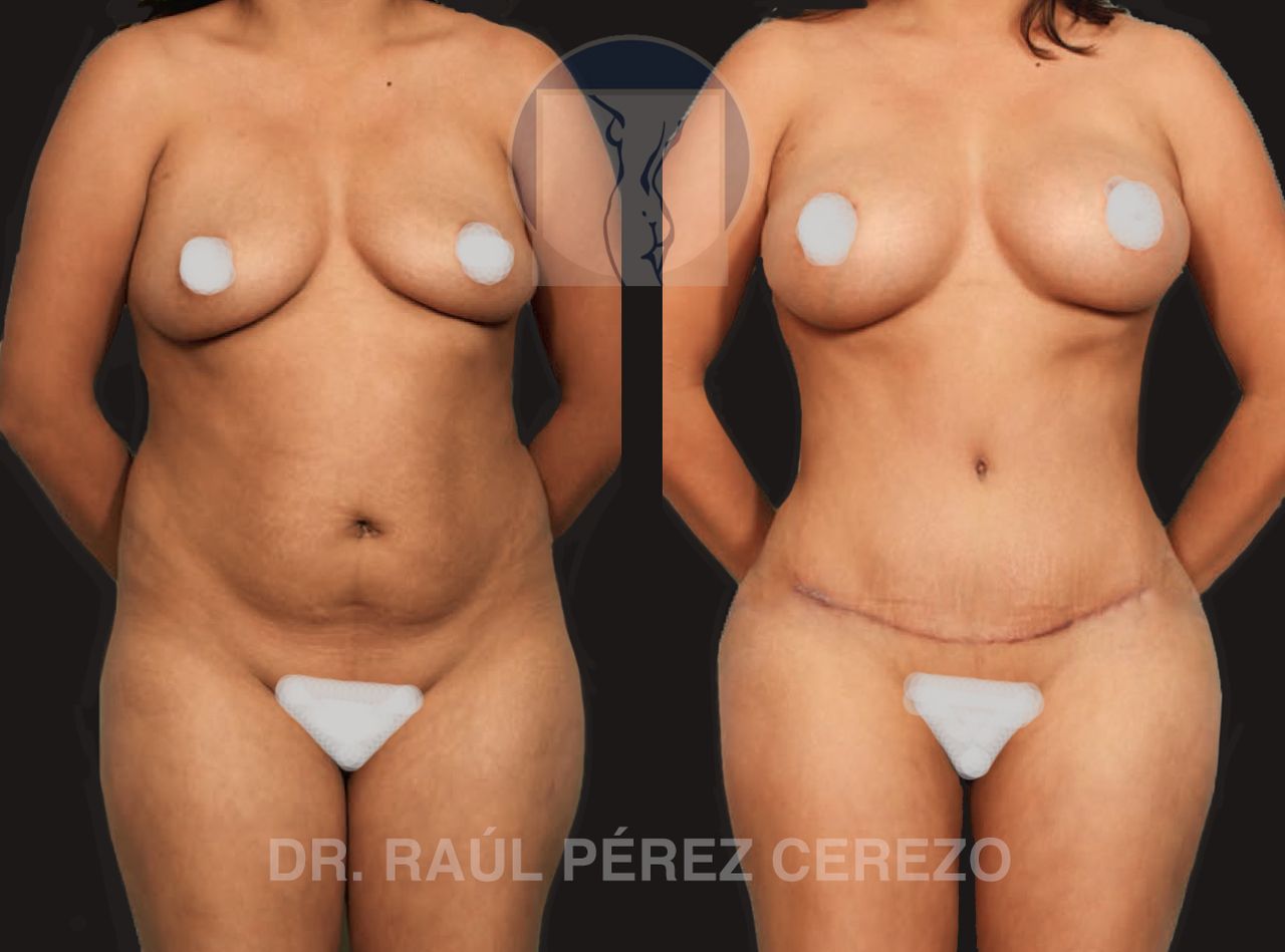 Raúl Pérez Cerezo-5