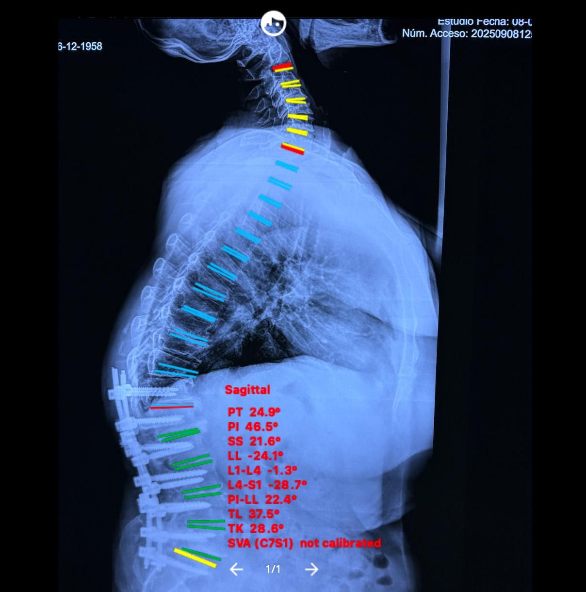 Arturo De Jesús Gomez Cano-32
