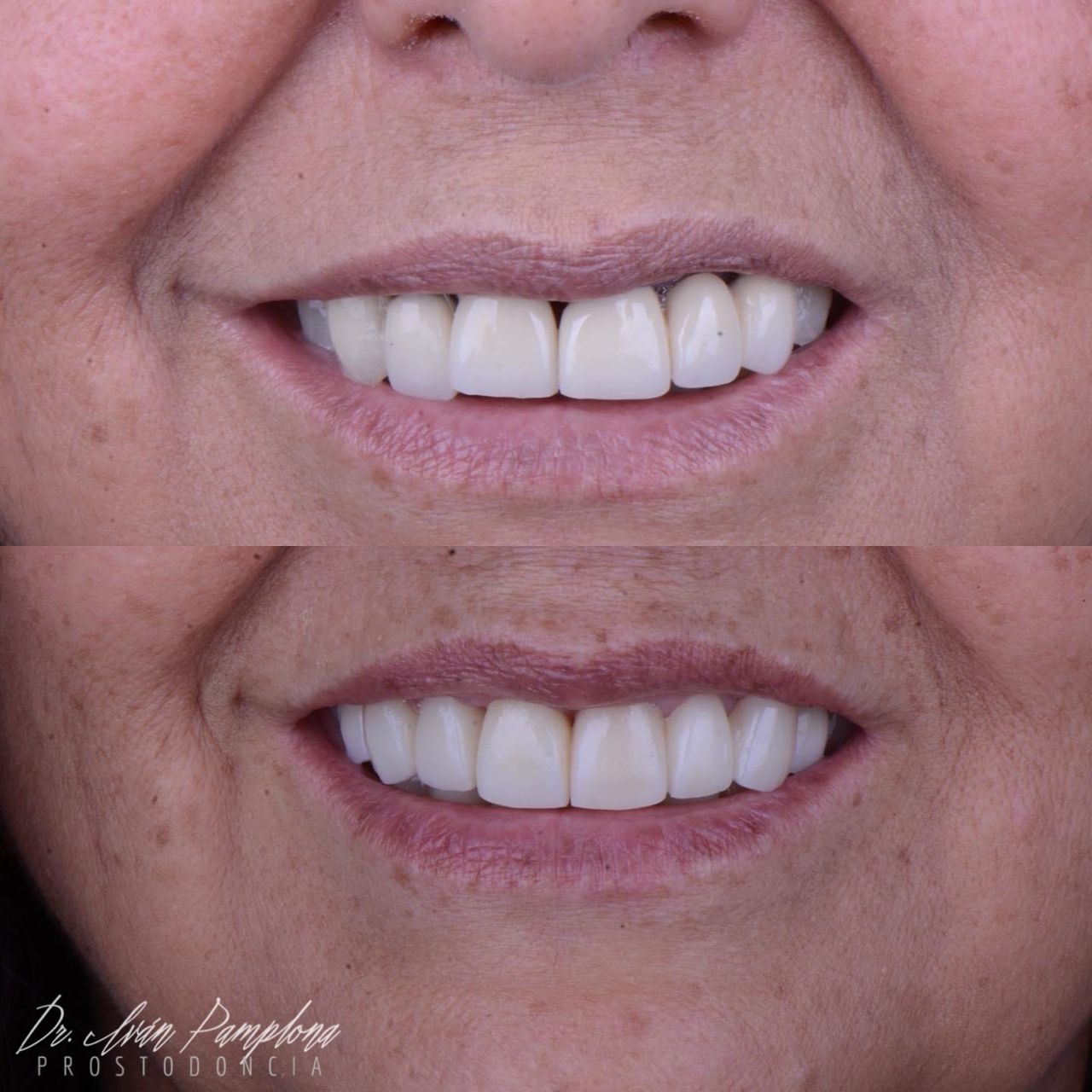 Iván Gerardo Pamplona Alfaro-11