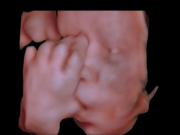 Rodolfo Antonio Gurrola Ochoa-4