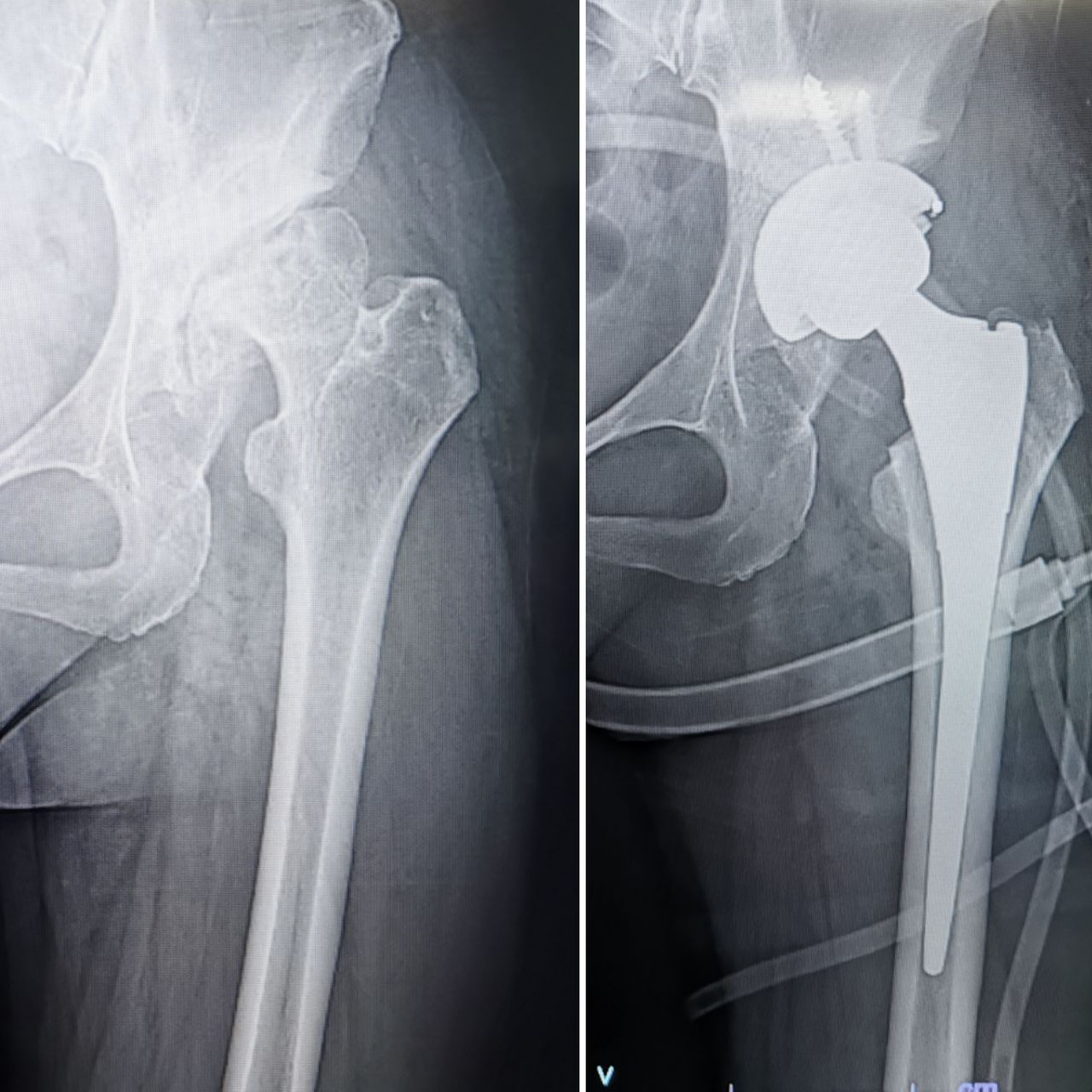 Avelino Colín Vázquez.-5